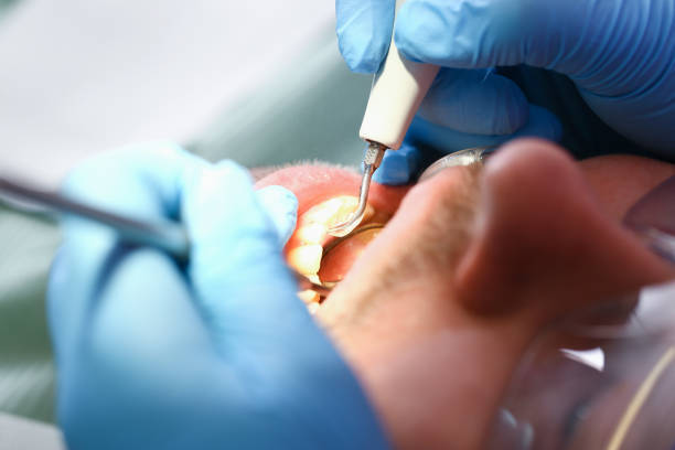 Best Cracked Tooth Emergency Dentist  in Bren Bow, OK
